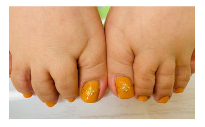 Nail 5/5